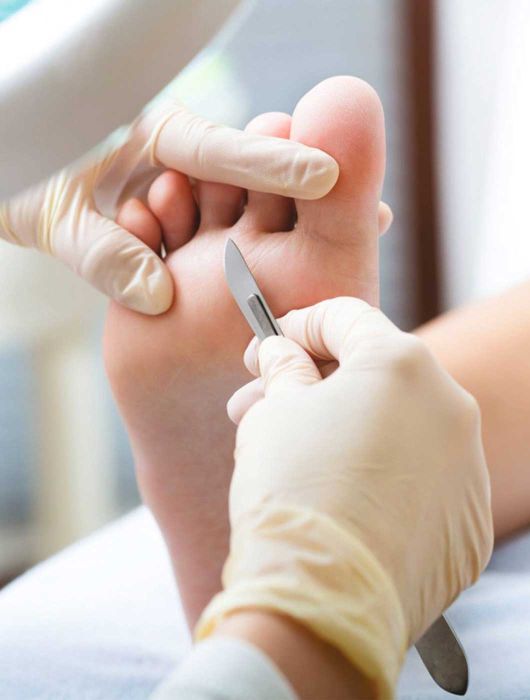 Studio di podologia Voghera, terapie riabilitazioni per i piedi e unghie e Controllo completo dei vostri piedi e unghie.
